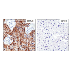 anti-EGFRvIII (human), Rabbit Monoclonal (RM419) (Biotin)