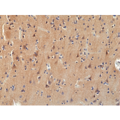 anti-TRK (pan) (human), Rabbit Monoclonal (RM423)