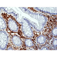 anti-Annexin A1 (human), Rabbit Monoclonal (RM424)