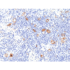 anti-CD30 (human), Rabbit Monoclonal (RM425)