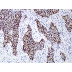 anti-SOX2 (human), Rabbit Monoclonal (RM427)