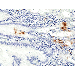 anti-Helicobacter pylori, Rabbit Monoclonal (RM429)