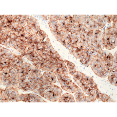 anti-CD73 (human), Rabbit Monoclonal (RM431)