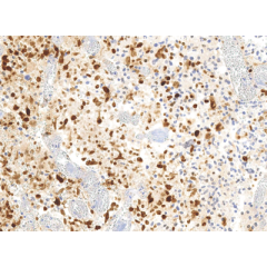 Histone H3.3 Mutation Antibody Panel (G34W, G34R, G34V)