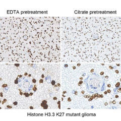 Histone H3 Mutation Antibody Panel (K4M, K9M, K27M, K36M)