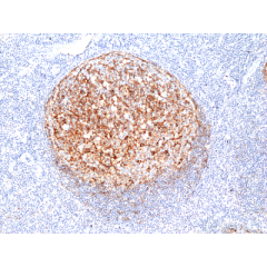 anti-Clusterin (human), Rabbit Monoclonal (RM437)