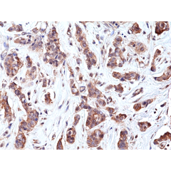 anti-p70S6K (human), Rabbit Monoclonal (RM438)