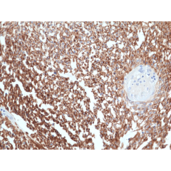 anti-ANO1 [TMEM16A] (human), Rabbit Monoclonal (RM440)
