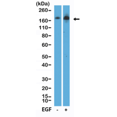 anti-EGFR (phospho Y1068) (human), Rabbit Monoclonal (RM443)