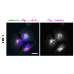 anti-Detyrosinated alpha-Tubulin (human), Rabbit Monoclonal (RM444)