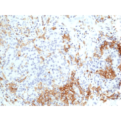 anti-TIM3 (Hepatitis A Virus Cellular Receptor 2), Rabbit Monoclonal (RM448)