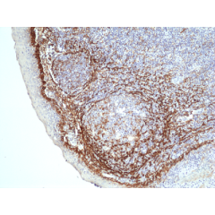 anti-Podoplanin (gp36), Rabbit Monoclonal (RM449)