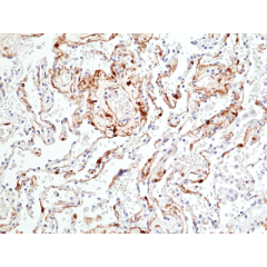 anti-Phospho-p44/42 MAPK (Erk1/2) (Thr202/Tyr204), Rabbit Monoclonal (RM451)