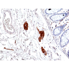 anti-Phospho-Tau (Ser396), Rabbit Monoclonal (RM461)