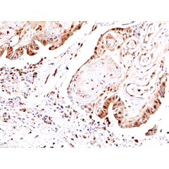 anti-Phospho-JNK1/2/3 (Thr183/Tyr185), Rabbit Monoclonal (RM464)