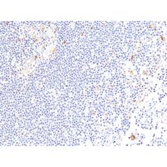 anti-CD137 (4-1BB), Rabbit Monoclonal (RM471)