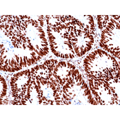 anti-MSH2 (C-Term) (human), Rabbit Monoclonal (RM478)