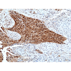 anti-p42 MAPK (Erk2), Rabbit Monoclonal (RM483)