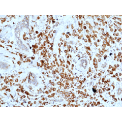 anti-MUC-1 (Mucin-1) (human), Rabbit Monoclonal (RM489)