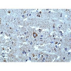 anti-&alpha;-synuclein (SYUA), Rabbit Monoclonal (RM492)