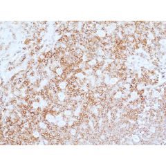 anti-CD45 (human), Rabbit Monoclonal (RM497)