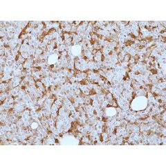 anti-Galectin-9 (human), Rabbit Monoclonal (RM499)
