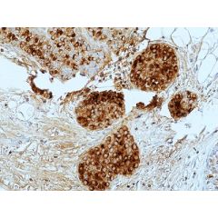 anti-GCDFP-15 (human), Rabbit Monoclonal (RM504)