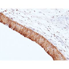 anti-UP2 (Uroplakin-2) (human), Rabbit Monoclonal (RM507)