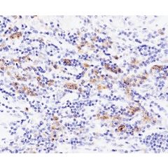 Immunohistochemical staining of formalin fixed and paraffin embedded human brain tissue section using anti-ALK rabbit monoclonal antibody (Clone RM361) at a 1:1000 dilution.