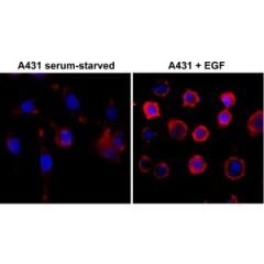 Immunocytochemistry of serum-starved A431 cells nontreated or treated with EGF, using RevMAb Clone RM111 at 1/500 dilution (foll-owed by a PE conjugated secondary antibody, red) and DAPI (blue).