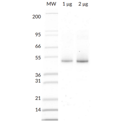 His<sub>6</sub>- Parkin SDS-PAGE. From left to right, increasing amounts of His<sub>6</sub>- Parkin (Prod. No. SBB-CE0055) were loaded onto a 4-20% SDS-PAGE gel and stained with coomassie brillant blue.