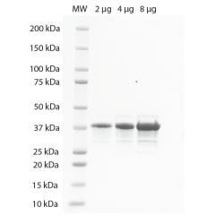 K48-Linked Penta-Ubiquitin SDS-PAGE. From left to right, increasing amounts of penta-ubiquitin were loaded onto a 4-20% SDS-PAGE gel, stained with Coomassie brillant blue. Purity is >95%.