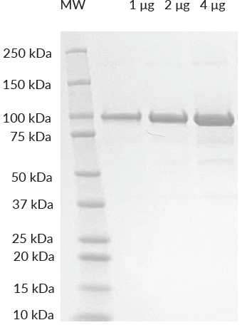 UBE3A SDS-PAGE. From left to right, increasing amounts of protein were loaded onto a 4-20% SDS-PAGE gel, stained with Coomassie brillant blue. Purity is > 98%. UBE3A SDS-PAGE. From left to right, increasing amounts of protein were loaded onto a 4-20% SDS-PAGE gel, stained with Coomassie brillant blue. Purity is > 98%.