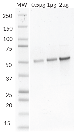 Biotin-Parkin SDS-PAGE. From left to right, increasing amounts of His6-Parkin were loaded onto a 4-20% SDS-PAGE gel and stained with coomassie brillant blue. Purity is >95%.