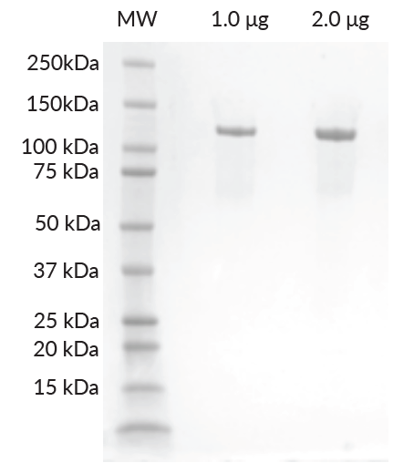 His-Avi-DDB1 SDS-PAGE. From left to right, increasing amounts of protein loaded onto a 10-20% SDS-PAGE gel, stained with Coomassie brilliant blue. Purity is >97%. His-Avi-DDB1 SDS-PAGE. From left to right, increasing amounts of protein loaded onto a 10-20% SDS-PAGE gel, stained with Coomassie brilliant blue. Purity is >97%.