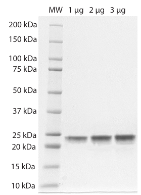 K48-Linked Tri-Ubiquitin SDS-PAGE. From left to right, increasing amounts of tri-ubiquitin were loaded onto a 10-20% SDS-PAGE gel, stained with Coomassie brillant blue. Purity is >98%.