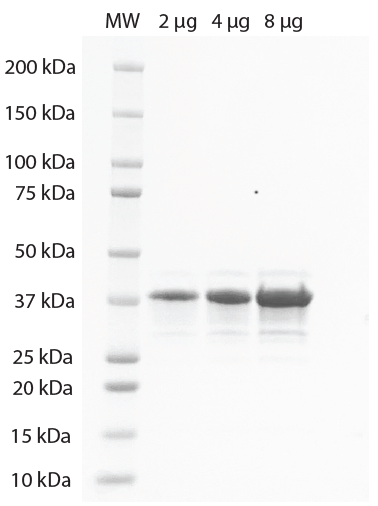 K48-Linked Penta-Ubiquitin SDS-PAGE. From left to right, increasing amounts of penta-ubiquitin were loaded onto a 4-20% SDS-PAGE gel, stained with Coomassie brillant blue. Purity is >95%.