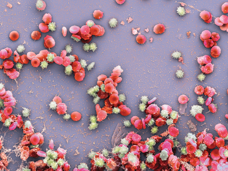 Human blood showing red blood cells, white blood cells, and protein structures.