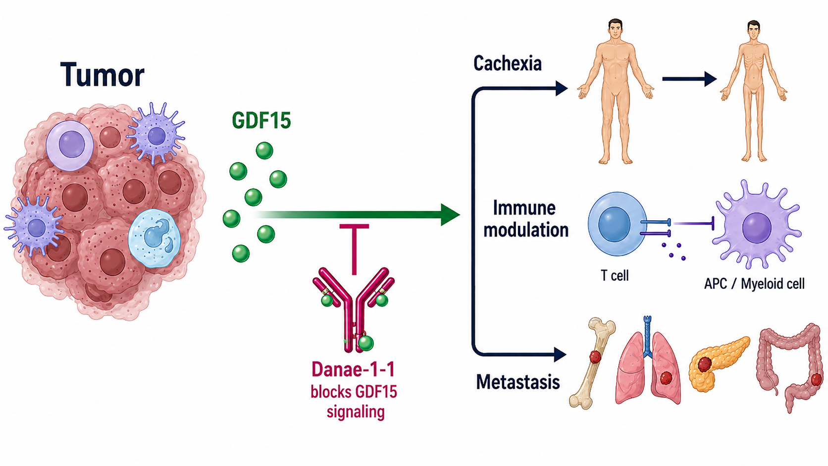 GDF15_Signaling_in_Cancer.png