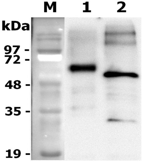 Deglycosylation of rat progranulin. To examine the deglycosylation of rat Progranulin-FLAG, 1 ?g of rat progranulin is denatured with 1X glycoprotein denaturing buffer at 100?C for 10 minutes. After the addition of NP-40 and G7 reaction buffer, two