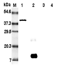 Western blot analysis of resistin using anti-Resistin (rat), mAb (RRES 07) (Prod. No. AG-20A-0015)  at 1:5'000 dilution. 1: Rat resistin:Fc fusion protein.2: Recombinant rat resistin protein (His-tagged).3: Recombinant human resistin pro