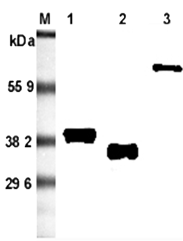 Western blot analysis using anti-Adiponectin (rat), mAb (RADI 264) (Prod. No. AG-20A-0036) at 1:5'000 dilution.1: Rat adiponectin (FLAG?-tagged).2: Recombinant rat adiponectin (His-tagged).3: Rat adiponectin Fc-fusion protein.