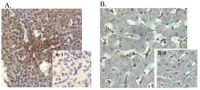 Immunohistochemical staining of human tissue using anti-ANGPTL4 (human), mAb (Kairos-1) (Prod. No. AG-20A-0038) at 1:500 dilution.A. Immunoperoxidase staining of formalin-fixed, paraffin-embedded human spleen (200x).A-1. Isotype control (negat