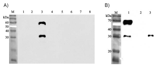 Western blot analysis using anti-ANGPTL3 (human), mAb (Kairos-37) (Prod. No. AG-20A-0039) at 1:2'000 dilution.
A.
1: Human ANGPTL1 (FLAG?-tagged).
2: Human ANGPTL2 (FLAG?-tagged).
3: Human ANGPTL3 (FLAG?<
