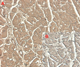 Immunohistochemical staining of human tissue using anti-ST2 (human), mAb (ST33868) (Prod. No. AG-20A-0044) at 1:100 dilution. A. Immunoperoxidase staining (cytoplasmic) of formalin-fixed, paraffin-embedded human heart (100x, brown colour). B.