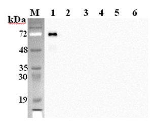 Western blot analysis using anti-DLK1 (mouse), mAb (PF183E) (Prod. No. AG-20A-0058Y) at 1:2'000 dilution.1: Mouse DLK1 Fc-protein.2: Human DLK1 Fc-protein.3: Mouse DLL1 Fc-protein.4: Mouse DLL4 Fc protein.5: Mouse Jagged-1 Fc