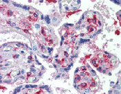 Immunohistochemical staining of DLK1 using anti-DLK1 (human), mAb (PF299-1) (Prod. No. AG-20A-0070) in placenta, villi (1:500 dilution). This antibody has been tested in immunohistochemistry, analyzed by an anatomic pathologist and validated for use