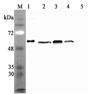 Western blot analysis using anti-Calreticulin (human), mAb (CR213-2AG) (Prod. No. AG-20A-0079) at 1:2'000 dilution.1: Human Calreticulin (His-tagged).2: HEK 293T cell lysates (100?g).3: HepG2 cell lysates (100?g).4: THP1 cell