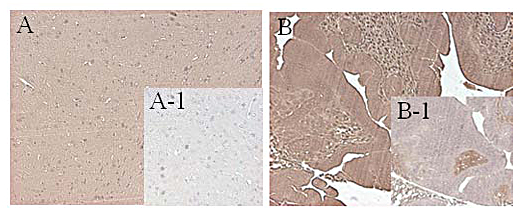 Immunohistochemical staining of mouse FTO using anti-FTO (mouse), mAb (FT62-6) (Prod. No. AG-20A-0083) in mouse tissue (1:500 dilution, 200X).A. Immunoperoxidase staining of formalin-Fixed, paraffin-embedded mouse brain.A-1. Isotype control, m