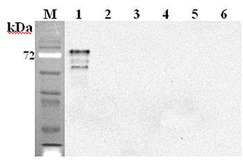 Western blot analysis using anti-DLL1 (mouse), mAb (D1L357-1-4) (Prod. No. AG-20A-0085) at 1:2'000 dilution.1: Mouse DLL1 Fc-protein.2: Human DLL1 Fc-protein.3: Mouse DLL4 Fc-protein.4: Mouse DLK1 Fc-protein.5: Mouse Jagged-1